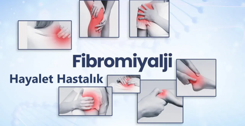 Fibromiyalji: Kas Romatizması Nedir?