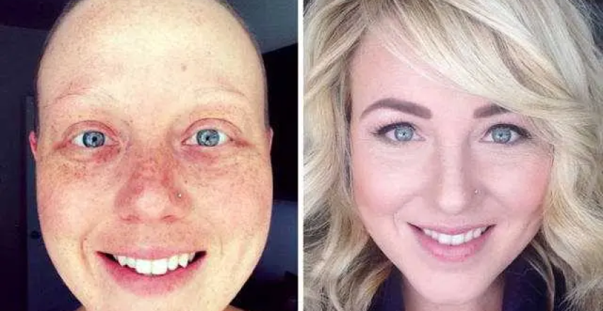 ÇAĞIMIZIN HASTALIĞI KANSER